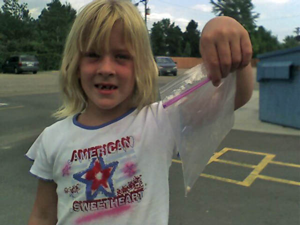 And ... yet another tooth down.